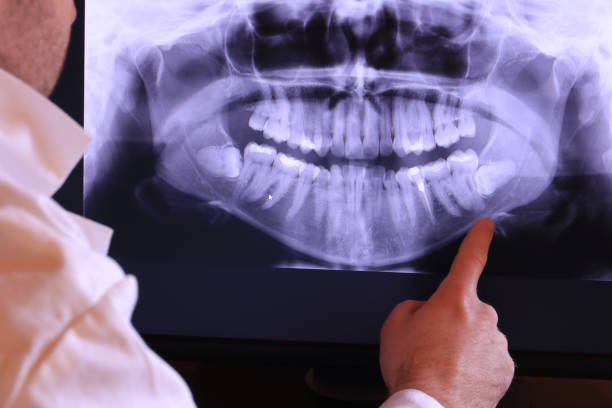 Best Emergency Dental Care for Abscessed Tooth in Rockford, MI